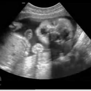 Meet your Posher, Candy